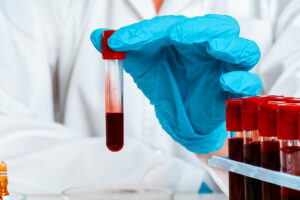 Blood test tube
